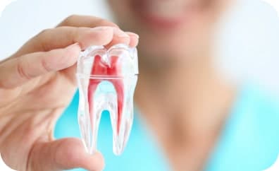 Tooth Root Canal Treatment