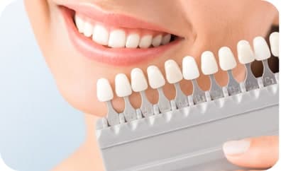Dental Laminate